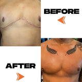 SCAR TAPE - 20PCS 10″ x 1″