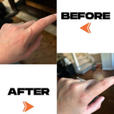 SCAR TAPE - 4PCS 6.5″ x 2″